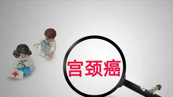 用擴陰器檢查會痛嗎_用擴陰器檢查會痛嗎_用擴陰器檢查會痛嗎