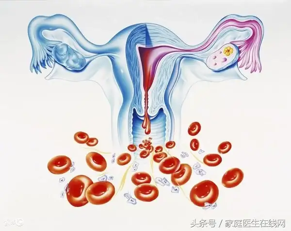 來月經時為什麼會經痛_經會導致月經延後嗎_經痛會來姨媽嗎