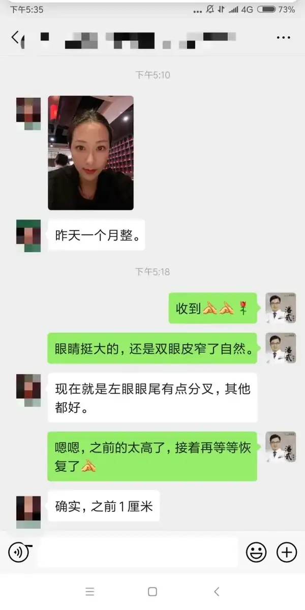 廣州雙眼皮修復吧{搜} _廣州雙眼皮手術修復_廣州十大雙眼皮修復醫生