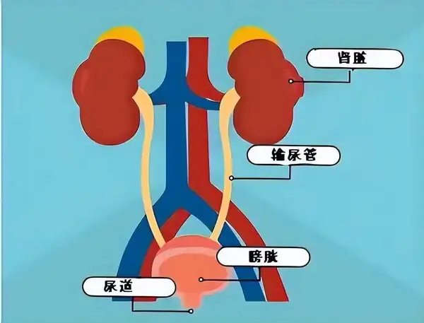 護理診斷尿路感染與什麼有關_尿路感染護理診斷_護理查房尿路感染