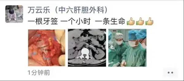 吞了牙籤時候會有反應_牙籤吞下去會有感覺嗎_吞進牙籤