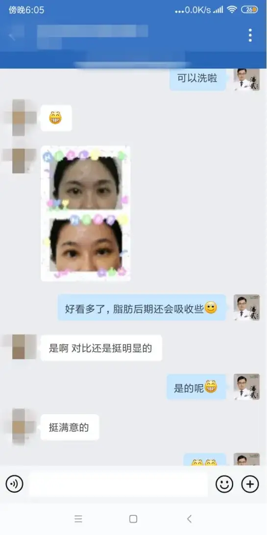 廣州雙眼皮修復吧{搜}_雙眼皮修復廣州_廣州雙眼皮手術修復