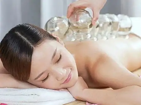 中醫拔罐後注意事項_中醫事項注意拔罐後吃什麼_拔罐之後注意什麼原因