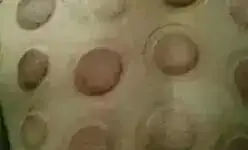 中醫拔罐後注意事項_中醫事項注意拔罐後注意什麼_中醫事項注意拔罐後吃什麼