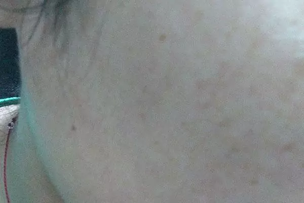 得枸杞喝長期皮膚黑好還是不好_長期喝黑枸杞皮膚好得不得了_喝枸杞皮膚會變黑嗎